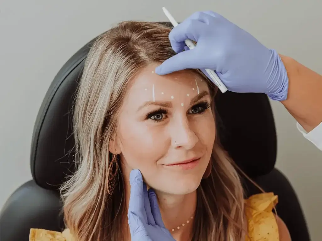Botox points on face | Wellness Co. | Zeeland, MI